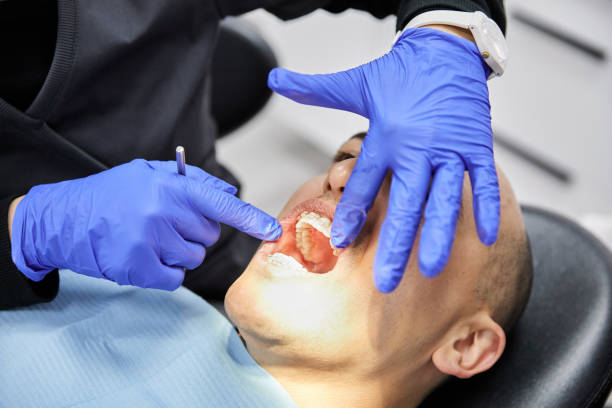 Best Dental Abscess Treatment in New Bedford, PA